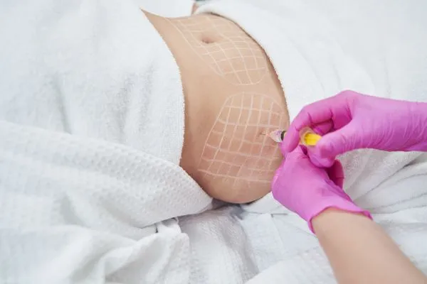 image of fat dissolving injections on love handles to help combat weight gain Fairfield