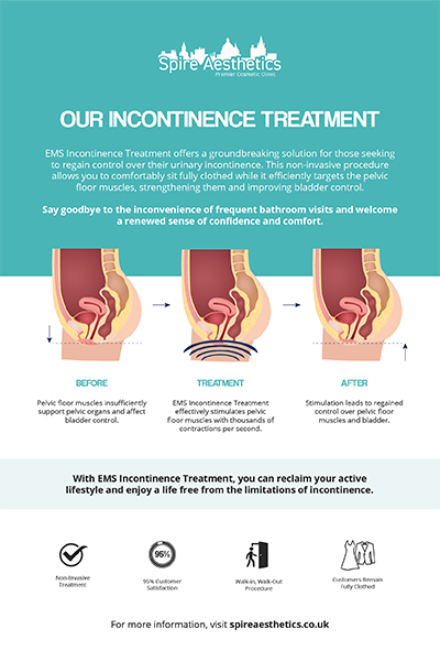 image of how urge incontinence Fairfield treatment works